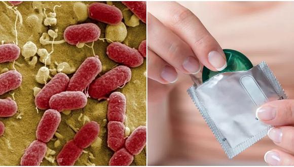 Bacteria "come carne" y que genera úlceras en genitales fue diagnosticada en Reino Unido