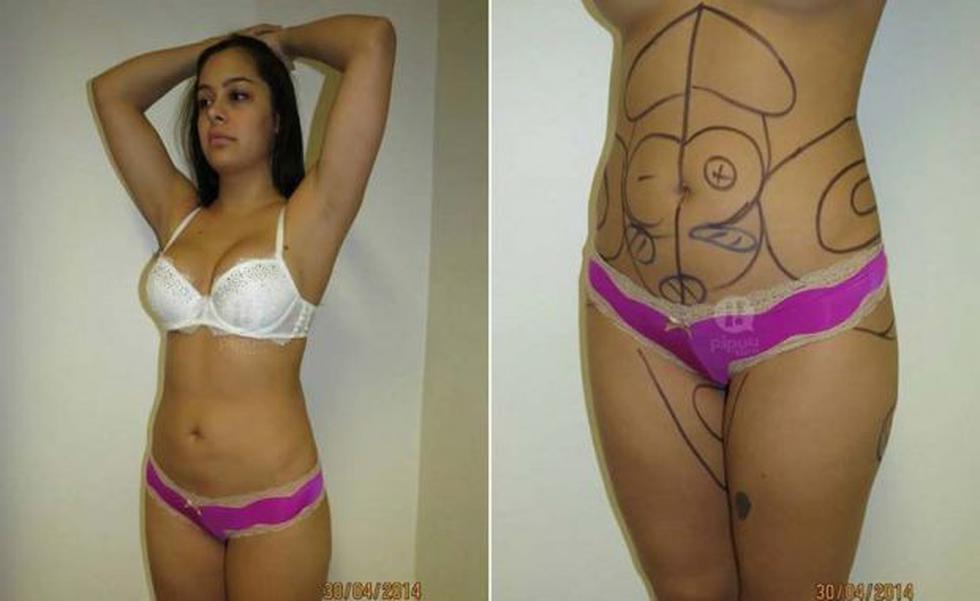 Filtran fotos de Larissa Riquelme antes de cirugía