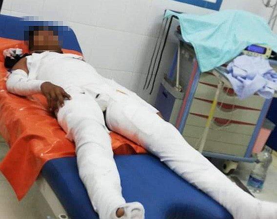 Menor lucha por vivir con el 70%  del cuerpo quemado