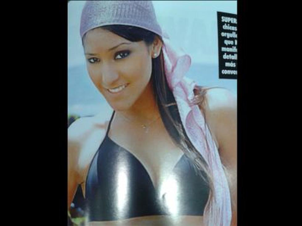 Aparecen más fotos de Karen Schwarz antes de sus cirugías