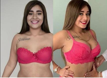 Gianella Ydoña participa en reality para mostrar todas sus cirugías