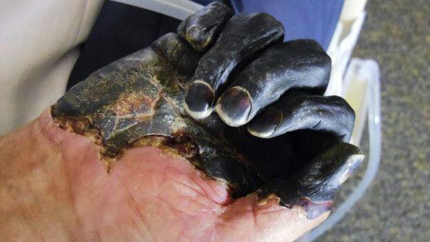 Alarmante: Aún persisten casos de Peste Negra en Perú (VIDEO)