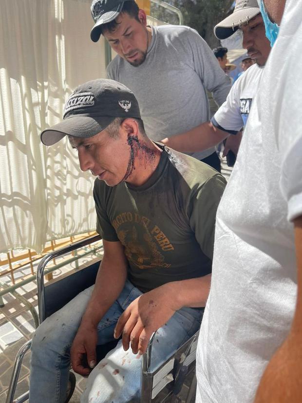 Artisanal miners were injured in a confrontation at the Callpa Renace mining center