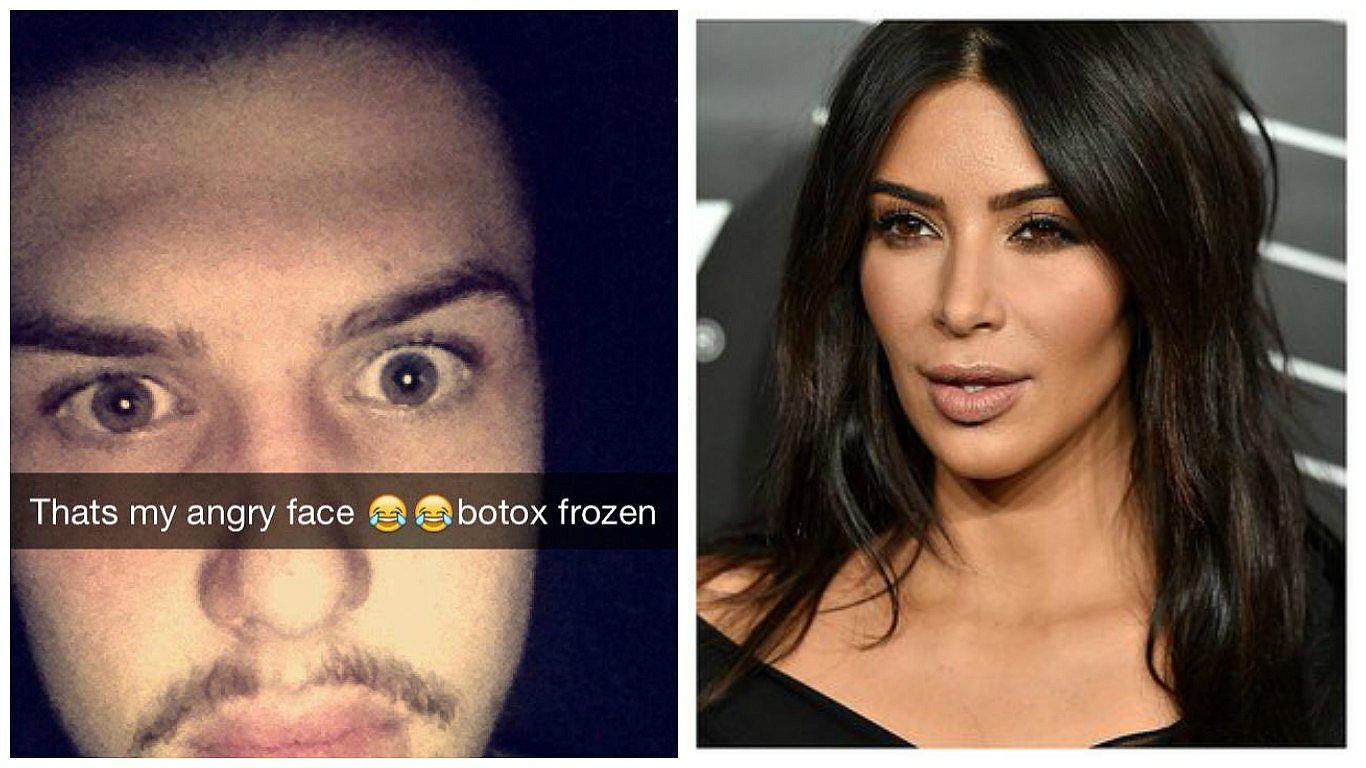 Hombre gasta 30 mil dólares para ser como las Kardashian y el resultado es dramático