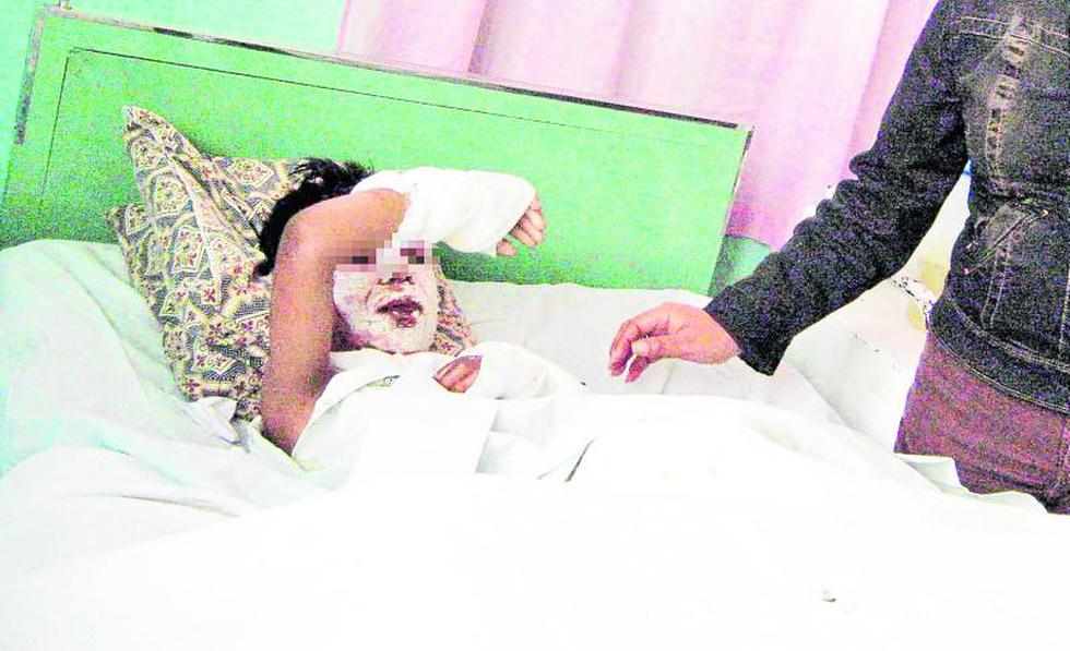 ´Mamarrata' explota y hiere a dos menores de edad