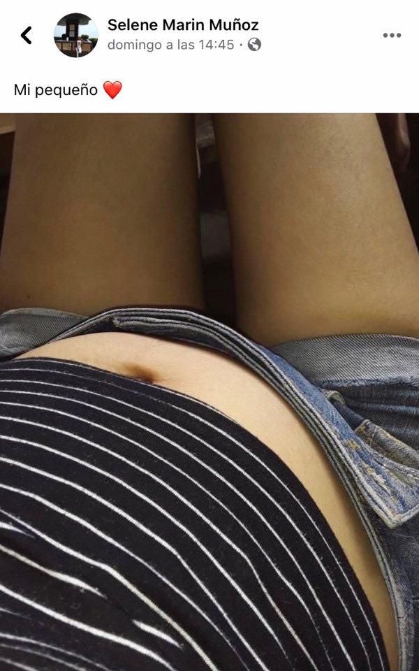 Embarazada de 26 semanas pierde a su bebé y lucha por sobrevivir tras ser alcanzada por incendio de VES