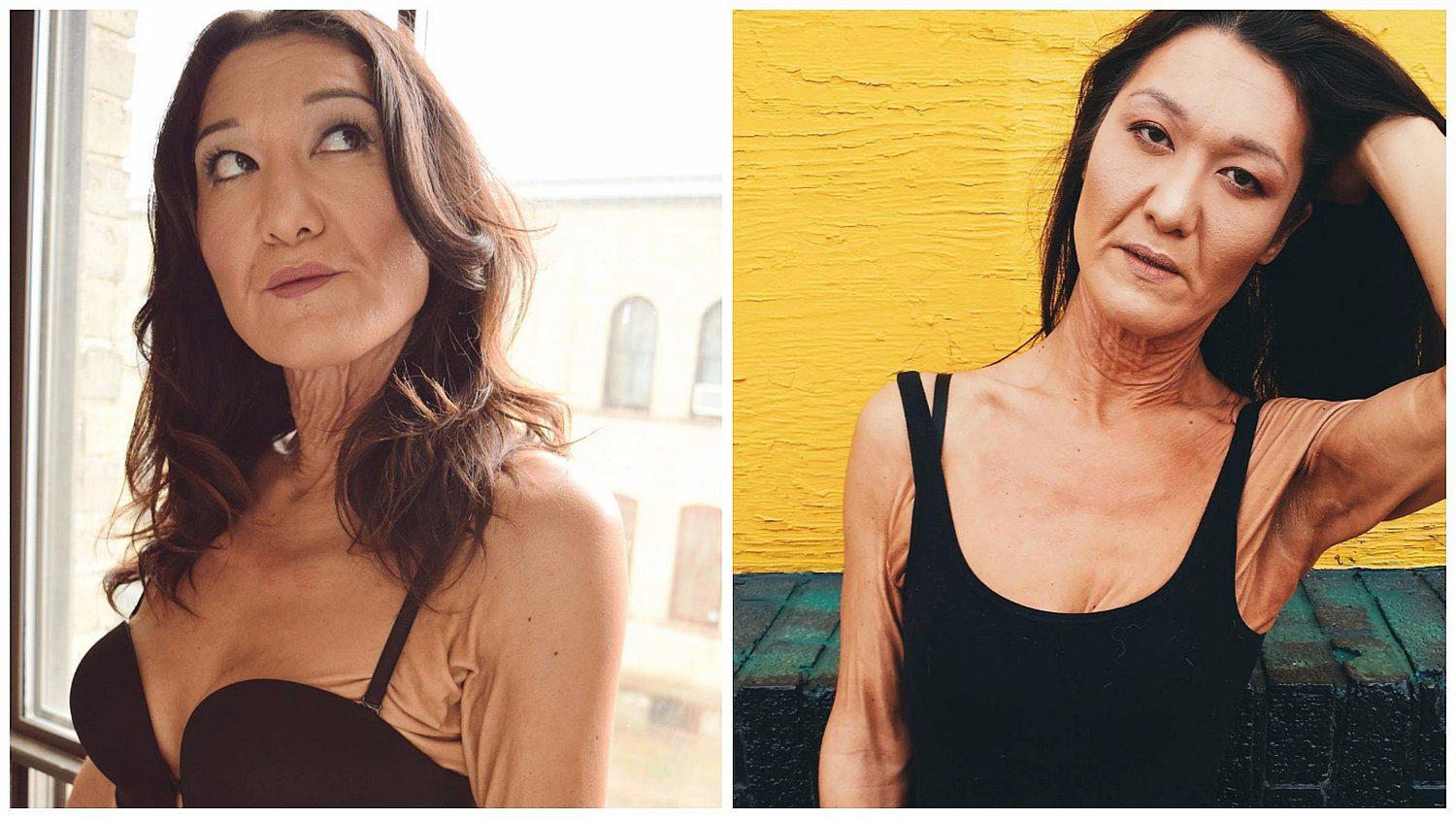 Modelo de 26 años tiene extraña enfermedad que la hace lucir como una anciana (FOTOS)