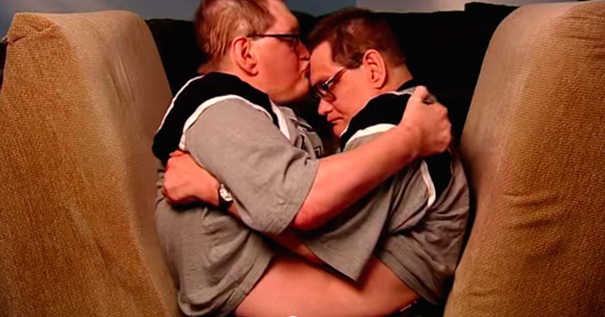 Conoce a Ronnie y Donnie: Los siameses vivos  más antiguos en la Historia