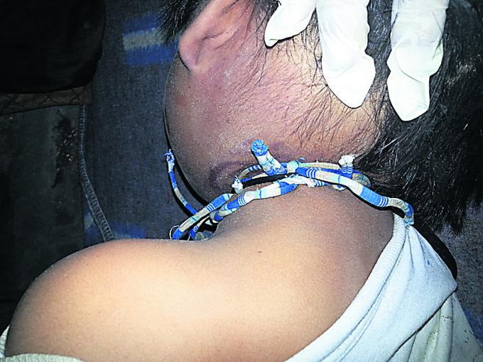 Menor estrangula a su primo de 5 años