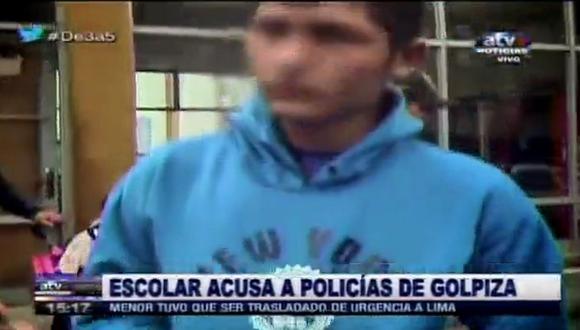 Escolar denunció golpiza por parte de policías en Tocache