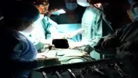 En un video se aprecia a los profesionales de la salud concluyendo con una cirugía de cesárea alumbrándose con celulares