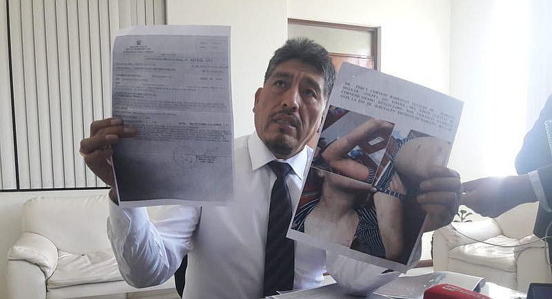 ​Alcalde de Mariano Melgar asegura que él fue el agredido