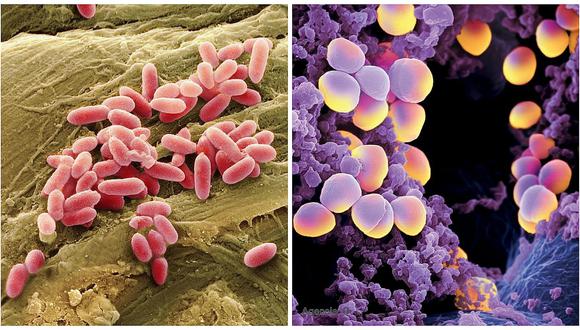 OMS: Estas son las 12 familias de "superbacterias" más peligrosas para el ser humano