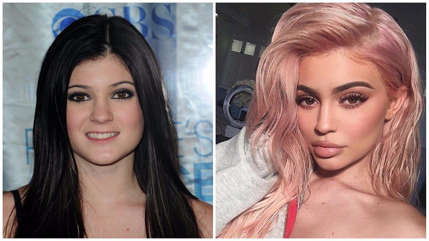 Kylie Jenner confiesa el traumático motivo por el que aumentó el tamaño de sus labios