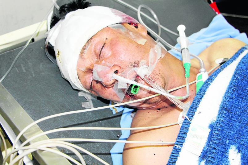 Ebrio aún no identificado muere luego de caer de un segundo piso