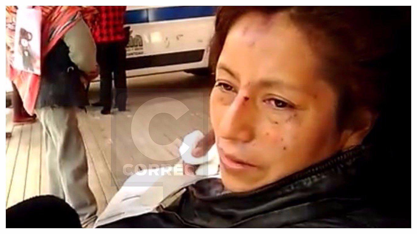 ​Enfermera herida dejó a un lado sus dolores y socorrió a víctimas de accidente