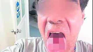 Piura: Delincuentes casi le cortan la lengua a un hombre durante un asalto
