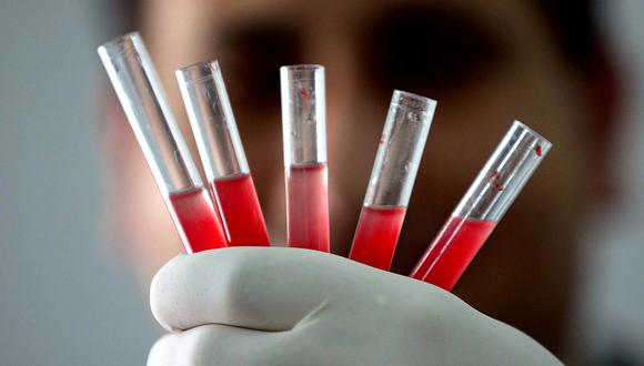 Este rarísimo tipo de sangre es también conocida como "Sangre Dorada"