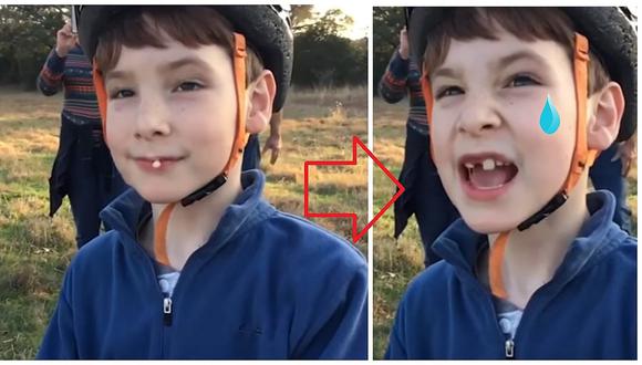 YouTube: niño usa drone para sacarse un diente (VIDEO)