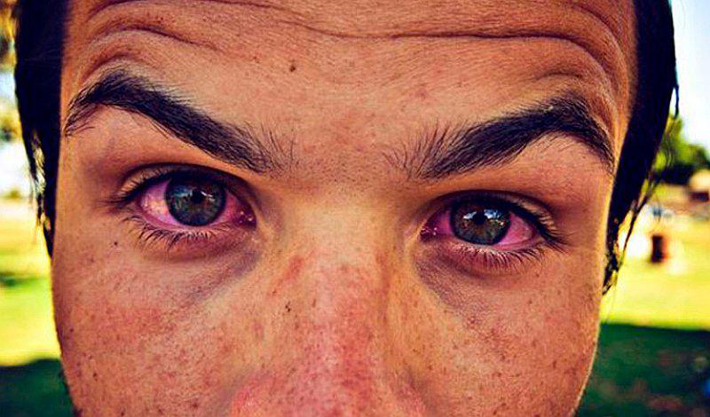 Conoce por qué los ojos se ponen rojos al fumar marihuana