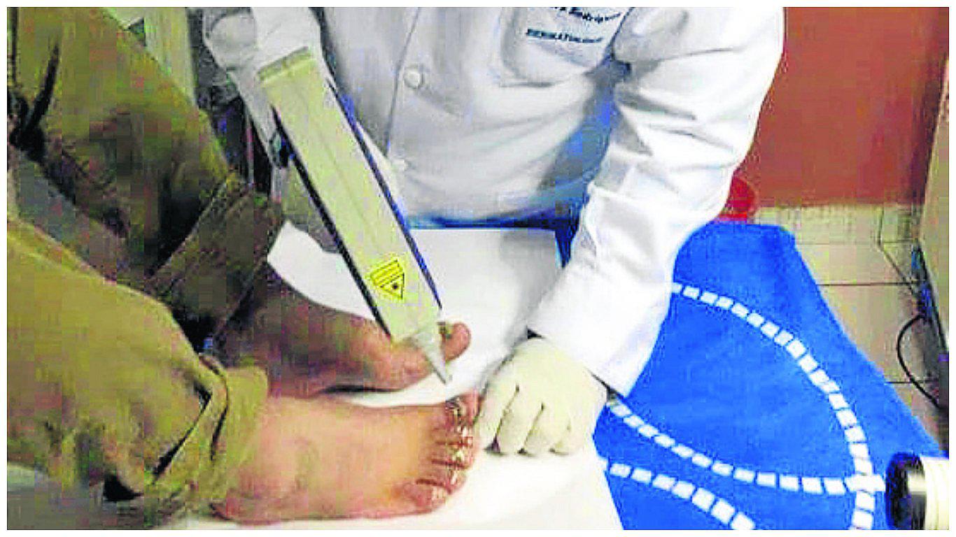 ​87 personas con extraños lunares concurren para saber si tienen cáncer de piel