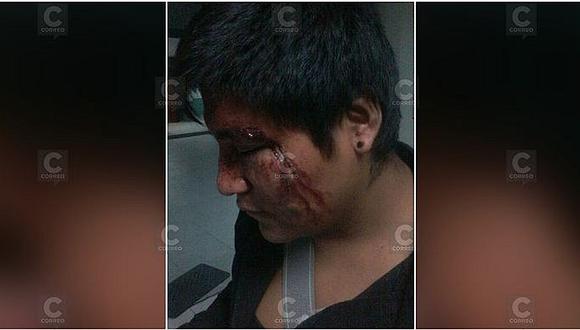 Tacna: dos estudiantes se lían a golpes a la salida de una taberna