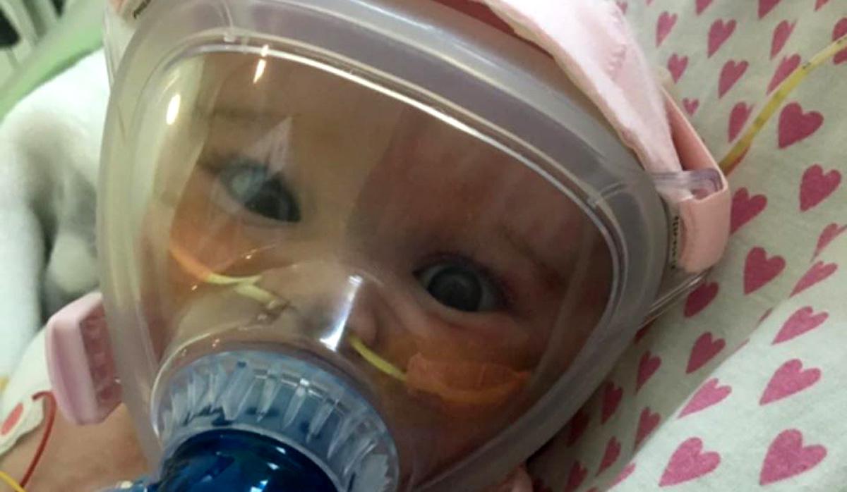 Erin Bates, de solo seis meses, ha sufrido duros episodios de salud a su corta edad. (Foto: Facebook Emma Bates)