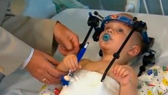 Médicos logran unir cabeza de bebé decapitado en accidente