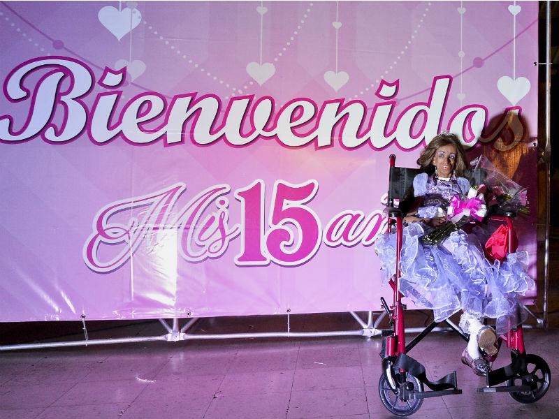 Niña con progeria cumplió 15 años con aspecto de 90