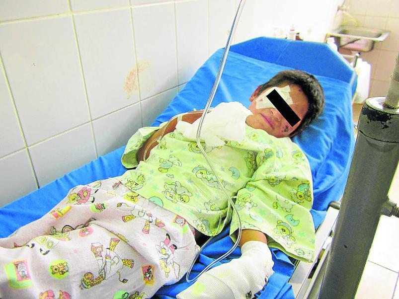 Escolar se quema al explotar olla mientras preparaba almuerzo