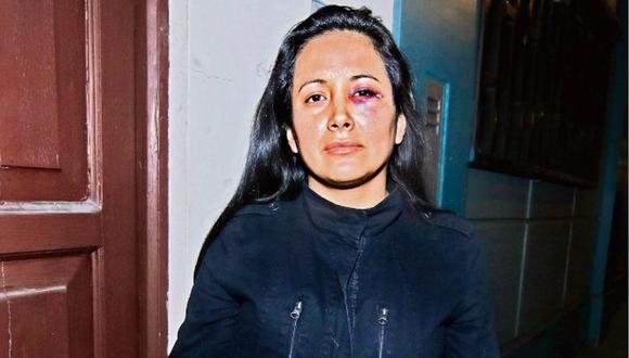 Coronel de la FAP en estado de ebriedad desfiguró el rostro de mujer en Miraflores (VIDEO)