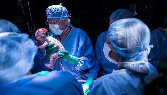 Estados Unidos: nace el primer bebé de un útero transplantado (VIDEO)