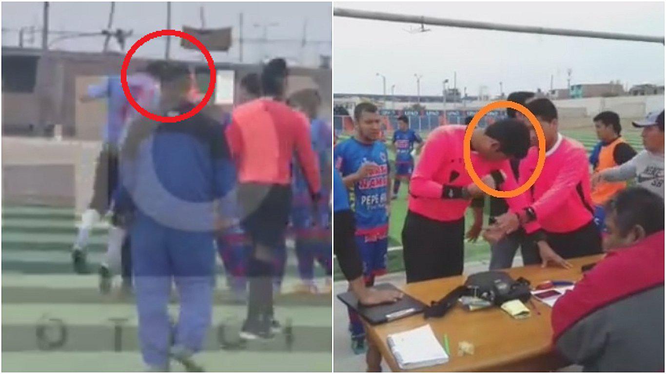 Copa Perú: árbitro terminó con un corte en la ceja tras ser agredido por futbolista (VIDEO)