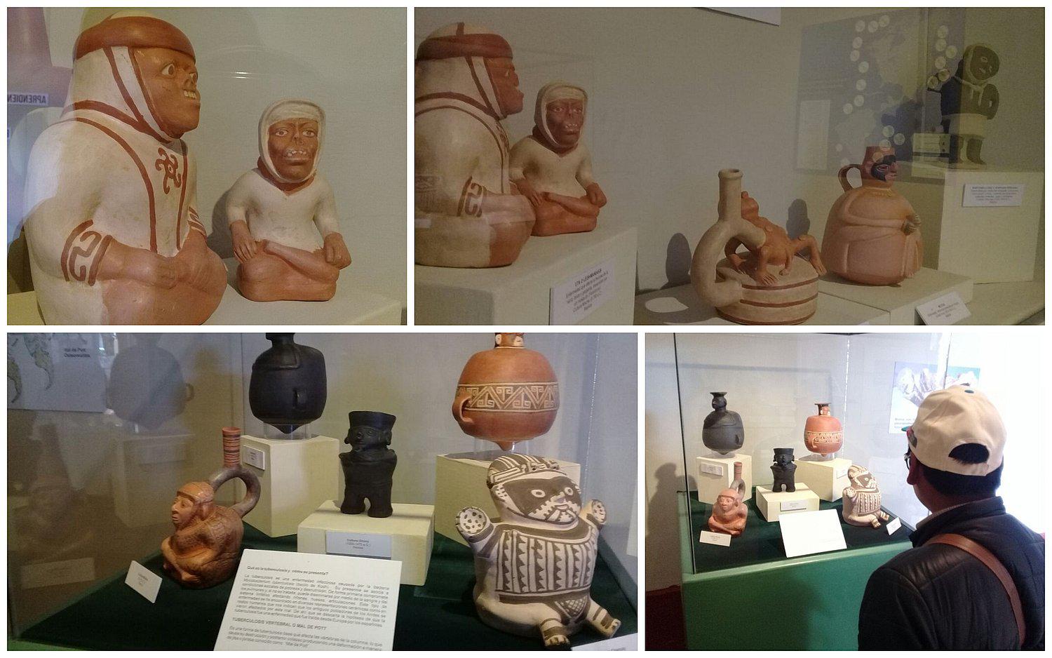 ​Peruanos prehispánicos ya sufrían de sífilis, micosis y tuberculosis