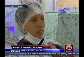 Un bebé que nació con "piel de mariposa" necesita ayuda