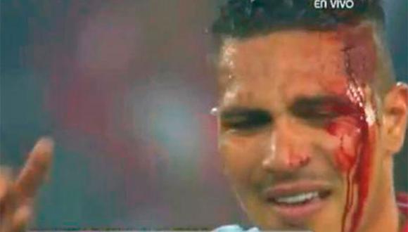 Paolo Guerrero sufrió corte en la cabeza en el Perú - Uruguay (VIDEO)