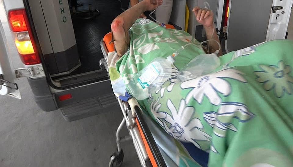 Tumbes: Estado de salud de mujer quemada en Zarumilla es grave