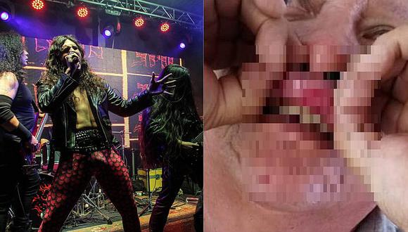 Vocalista de banda de metal agredió a taxista de aplicativo (FOTO)