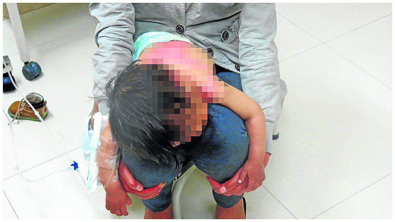 Navidad 2016: Niños terminan con quemaduras por cohete y caldo