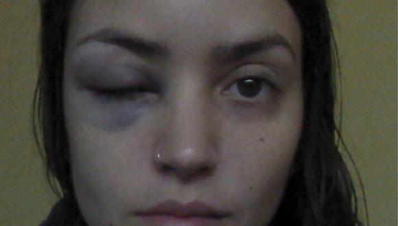 Ni Una Menos: argentina denuncia por FB que policía no la ayudó luego de que intentaran violarla