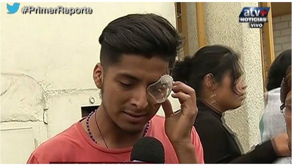 Puente Piedra: estudiante perdería la vista trae caerle perdigón durante protesta (VIDEO)
