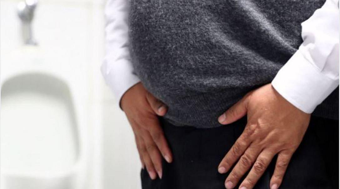 Lima: hombres podrán someterse a vasectomía sin bisturí de forma gratuita