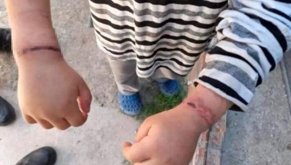 Un menor de 5 años fue encontrado en estado de maltrato y desnutrición. Tenía las manos atadas con alambres. (Foto: Redes Sociales)