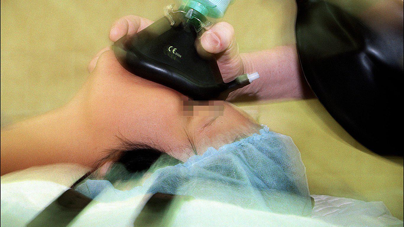 Conoce la historia de una mujer que se despertó en plena operación