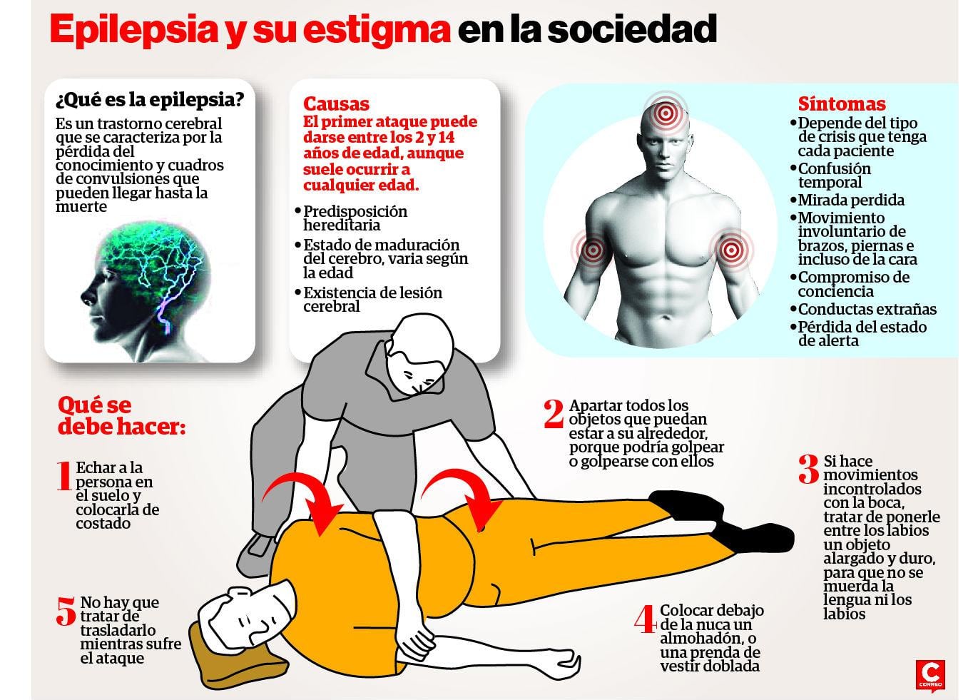 ​La epilepsia, un problema de salud pública que se incrementa 