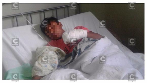 Niño pierde tres dedos de la mano al detonar cohetón que encontró en la calle