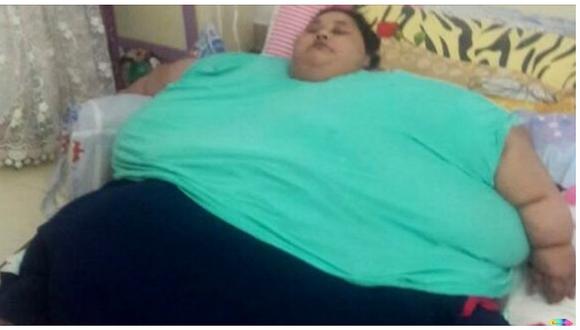India: la mujer más obesa del mundo perdió 100 kilos tras ser operada 