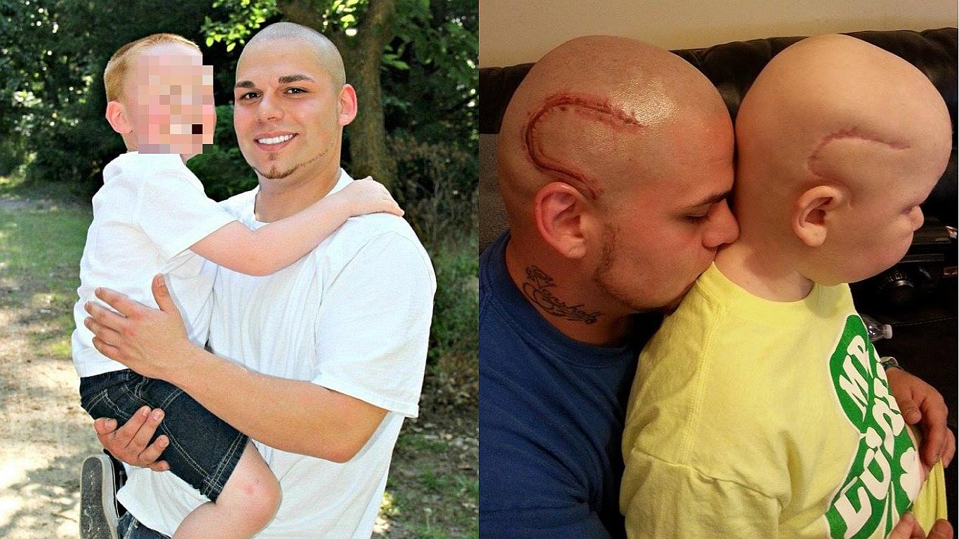 Gabriel Marshall: muere el niño cuyo padre se tatuó una cicatriz para hacerlo sentir mejor (FOTOS)