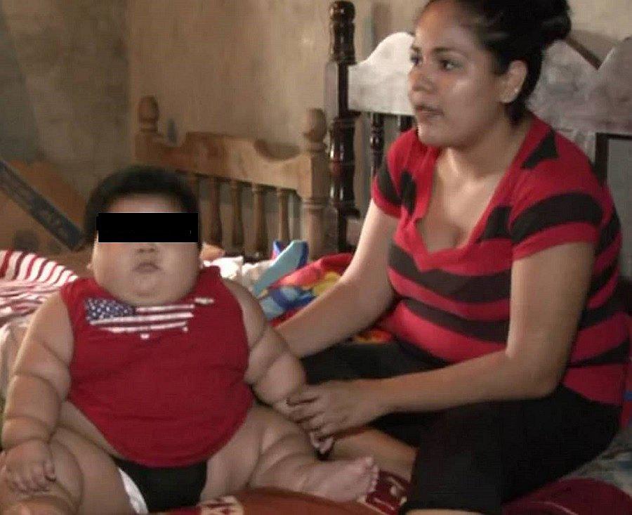 Bebé más obeso del mundo tiene 10 meses y pesa como niño de 9 años (FOTOS)