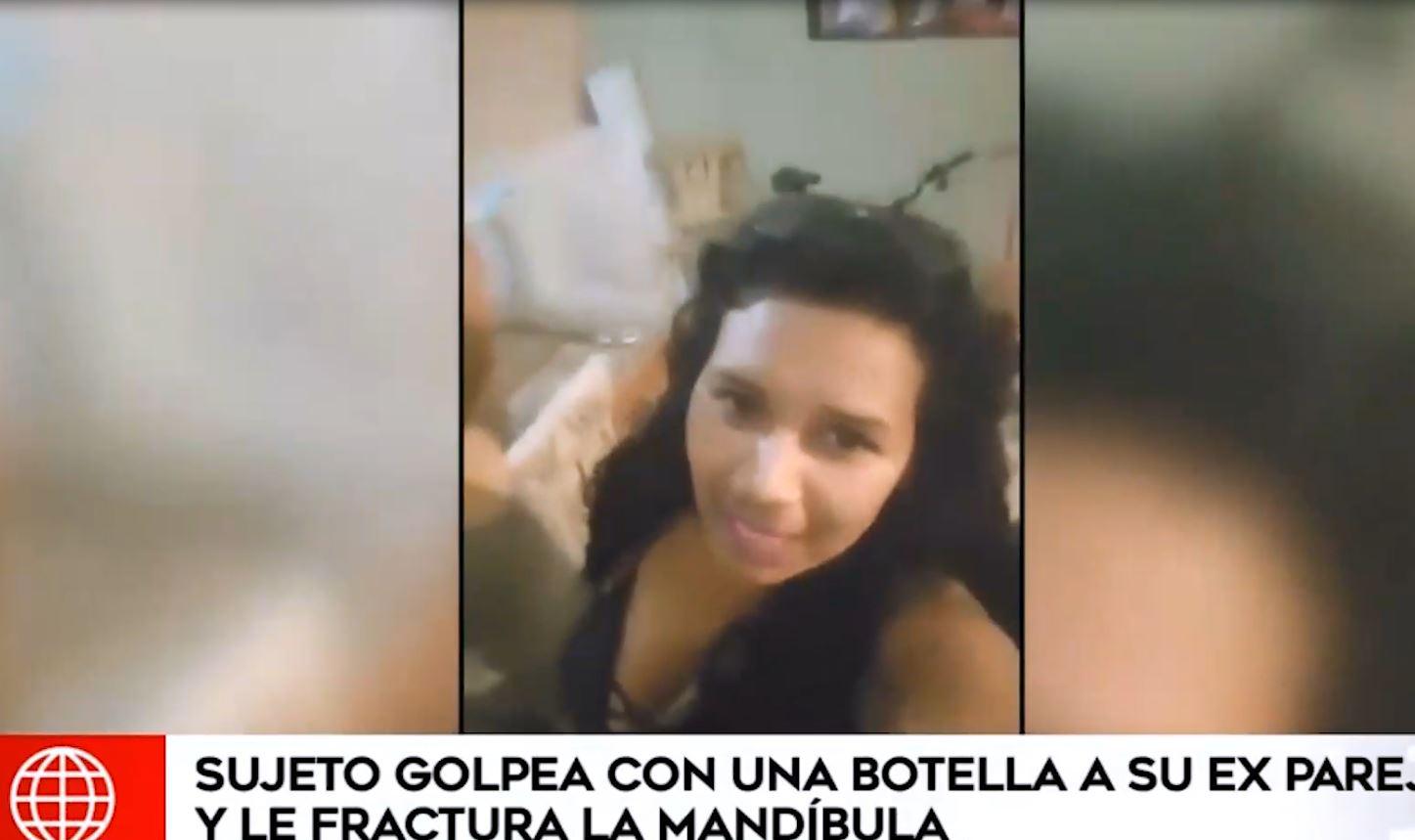 Callao: acusan a sujeto de golpear a su pareja tras pelea. Foto: Captura América
